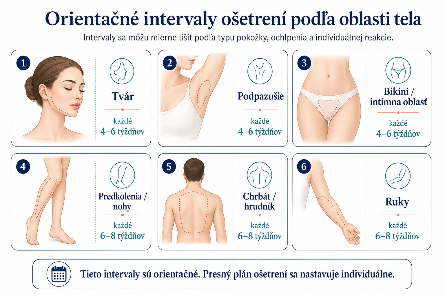 Prehľad odporúčaných intervalov medzi ošetreniami laserom pre rôzne oblasti tela