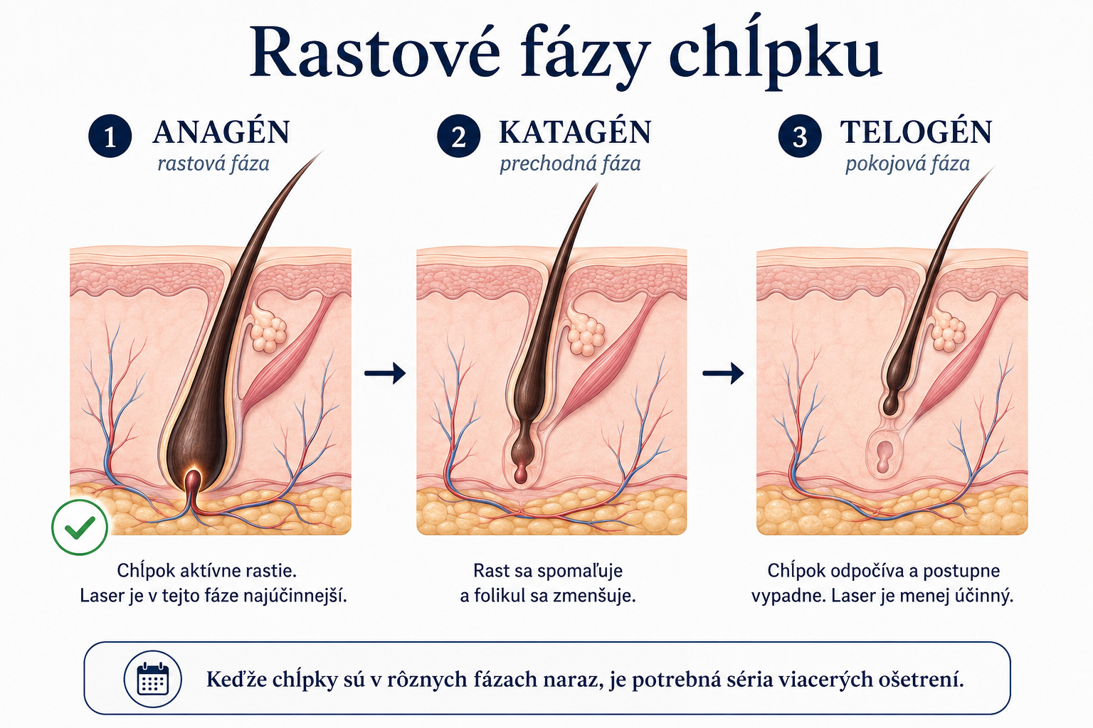 Schematické znázornenie troch rastových fáz vlasového folikulu: anagén, katagén a telogén