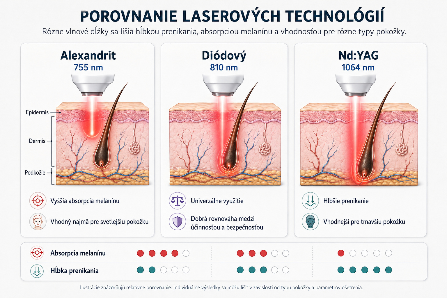 Porovnanie vlnových dĺžok diódového, alexandritového a Nd:YAG lasera